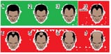 the-norwood-scale-example-chart