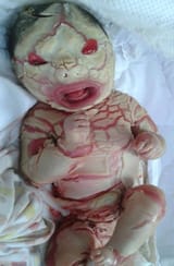 depleted_uranium_munition_iraq_babies