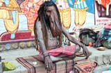 sadhu leprosy