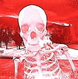 bones10