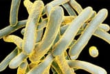 1800ss_getty_rf_tuberculosis_bacteria