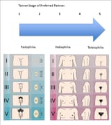 Tanner-scales-of-males-and-females-as-used-in-sexual-preference-assessment-Image