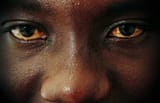 bloodshot-eyes