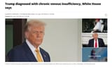 Screenshot 2025-07-17 at Trump diagnosed with chronic venous insufficiency White House says