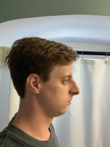 jewish phenotype