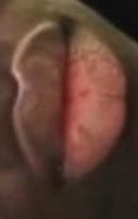 pussylips