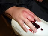 fingered