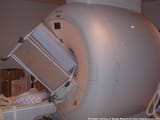 MRI_2