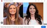face bristol palin jaw