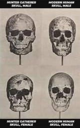 chad skull