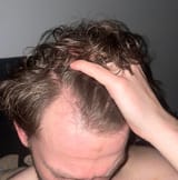 56