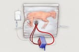 system-with-lamb-1-_custom-2b9a2