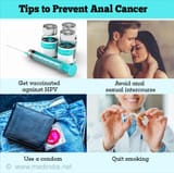 tips-to-prevent-anal-cancer-180715144