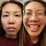 chink2