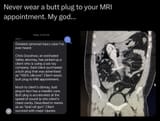 mri3_buttplug