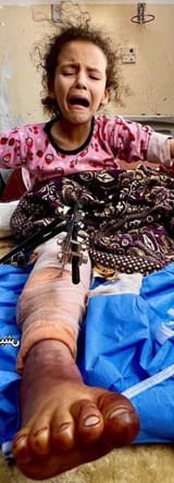 pali loli toes