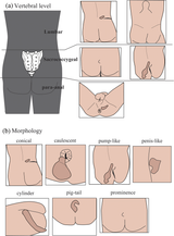 Diversity-of-the-human-tail-a-The-human-tail-can-be-divided-into-three-types-based