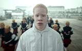 albino gosh-splash