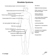 klinefelter_syndrome