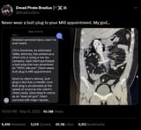20241119-WoreButtPlug-to-MRI-Appointment-Became-an-AnalRailGun