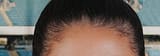 Brown subhuman hair