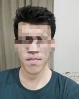 1000026713
