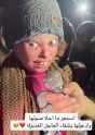 pali kid white phosphorous burn_thumb.jpg