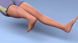Rotationplasty