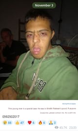 Ugly Deformed Inbred Palestinian Gaza missing2