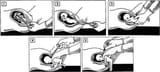 abortion