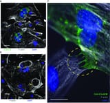 SARS-CoV-2-spike-protein-induces-syncytia-in-hiPSC-CMs-A-IF-confocal-microscopy-of