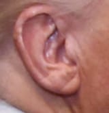 The Ear