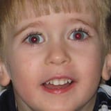 redeyes1