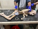 gaza famine
