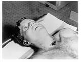 A_picture_of_President_Kennedy&#039;s_head_and_shoulders_taken_at_the_autopsy