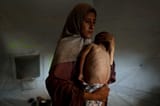 starving child gaza 19