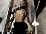 gaza famine 2