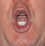 1722632891341556