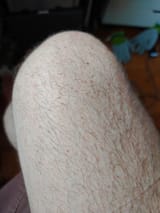 1000004985