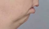 GxNNGAUXkAAmlM0