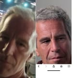 eptein face compare thailamd scar