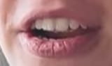 lips