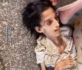 gaza famine 78569