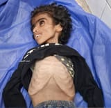 gaza famine785