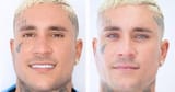 Osmani Garcia eye color surgery