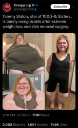 FatRenoval