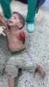 gaza armless boy_thumb.jpg