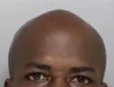 conehead