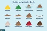 healthy-and-unhealthy-stool-89211-color-V1-9cef9502a0a5433994307575289f34c7