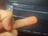 posthandshitskin